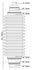 couvercle dessieu de direction 1set 1pc